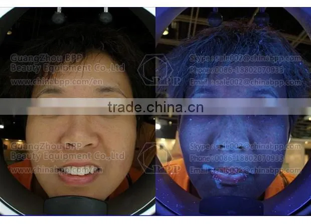 RGB and UV spectrum skin analysis camera for analysis skin characteristic