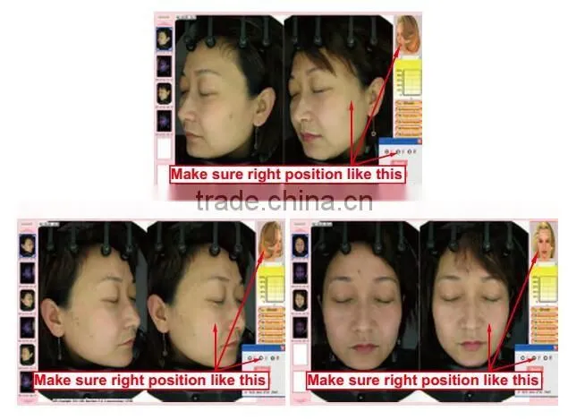 Hottest !!!Best Professional Skin Analysis Machine / Facial Skin Analyzer/beauty Equipment