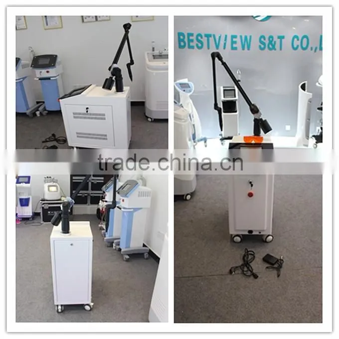 Bestview supply Tattoo remover nd yag laser