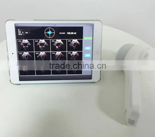 Sonostar new 3D 4D laptop ultrasound scanner ipad ultrasound scanner for sale BProbe-2