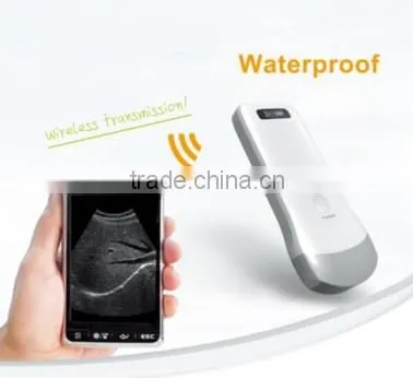 UltraSound Scanner, Convex Probe Ultrasound Scanner, WiFi, 3.5MHz / R40 / 64 Elements, SIFULTRAS-5.1