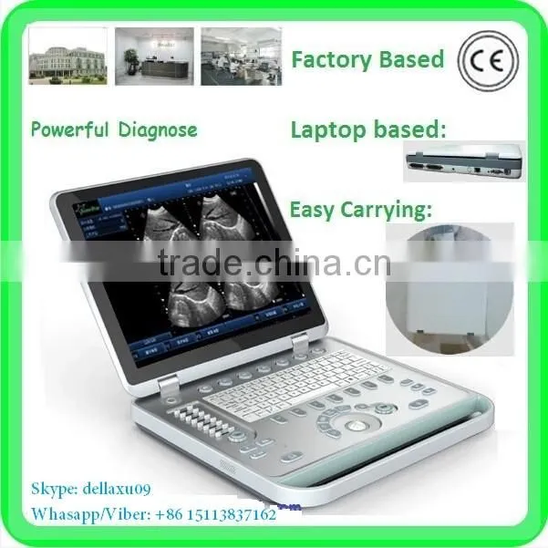 MSLPU25A HOT SALES Digital best Medical portable china portable ultrasound machine price