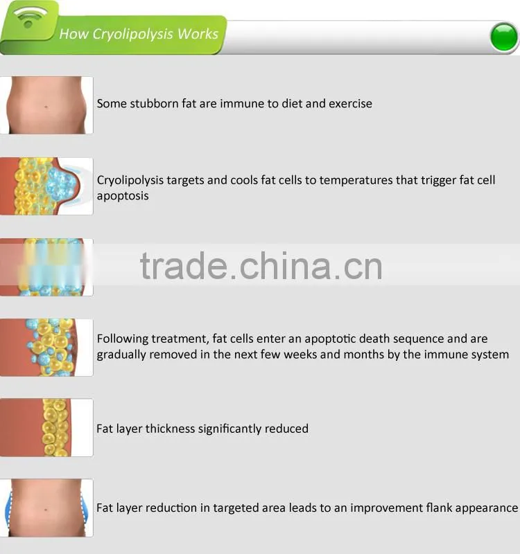 Cryolipolysis equipment with CE certificated, 3 cryo handles, 8-inch LCD touch screen, suitable for spa,salon,beauty center