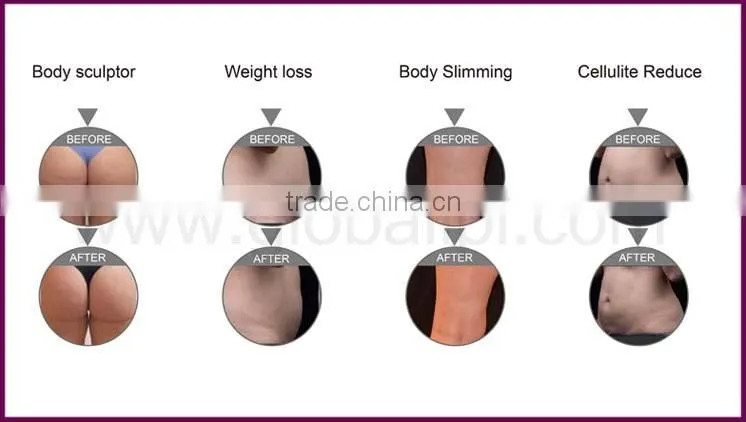 beauty equipment focal hifu for wholesales