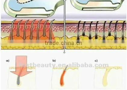 ce approve vertical ipl hair removal machine with 3 filters A006