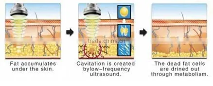 portable cavitation machine, liposlim cavitation machine, trilipo cavitation machine
