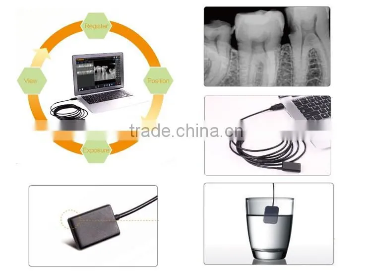 digital x-ray sensor for dental application