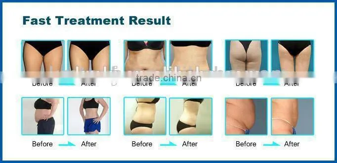 portable multifunction beauty machine cavitation Break up lipocytes body shaping Whiten skin equipment