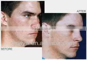 VY-900A Newest Crystal And Diamond Microdermabrasion Peel Beauty Machine