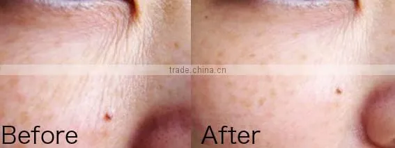 Japanese high quality anti aging face serum for sale