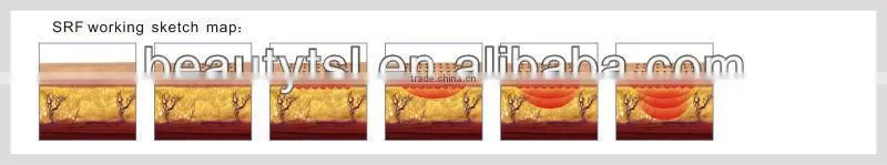 LINGMEI manufacturer salon use rf cooling thermgic face lifting machine/fractional rf face lifting equipment