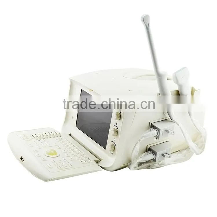 cheap prices of medical ultrasound machine for pregnancy
