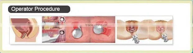USA RF tube fractional co2 laser skin resurfacing