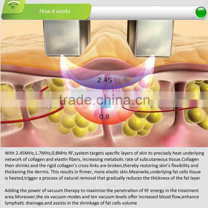 2015 Hot selling vacuum RF machine, 3 RF frequency of 0.8MHz&1.7MHz&2.45MHz,for facial lifting&body contouring
