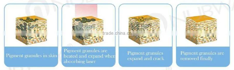 Safe&effective 1064nm 532nm single pulse q switched nd yag laser