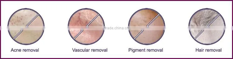 Hot selling Fashion handles ipl machine home use with CE certificate
