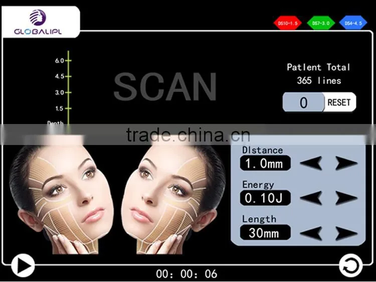 2016 HIFU Vertical hifu ultrasound skin tightening machine for home use