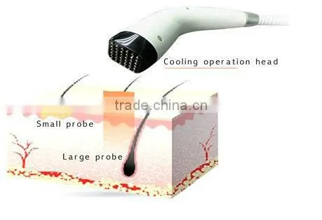 2013 lattest monpolar rf aesthetics equipment, Rhermage (Perfect skin rejuvenation result after just 1 time treatment!!!!)