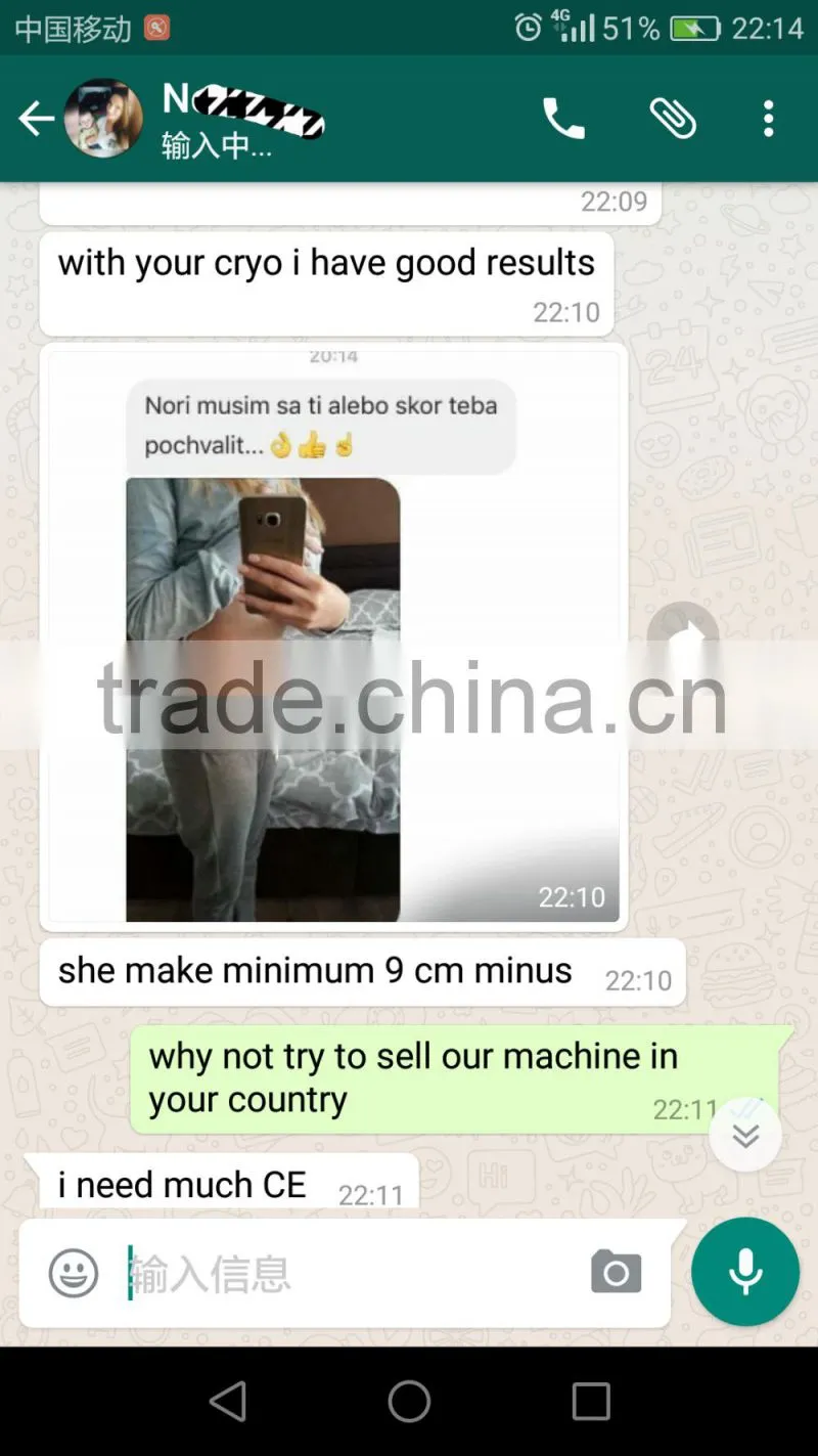 Christmas promotion! ultrashape cavitation RF liposuction slimming machine