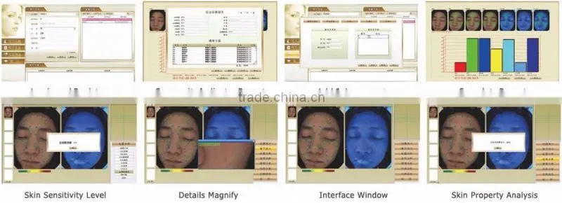 Portable skin scanner analyzer/skin analyzer machine/Magic mirror facial analysis machine