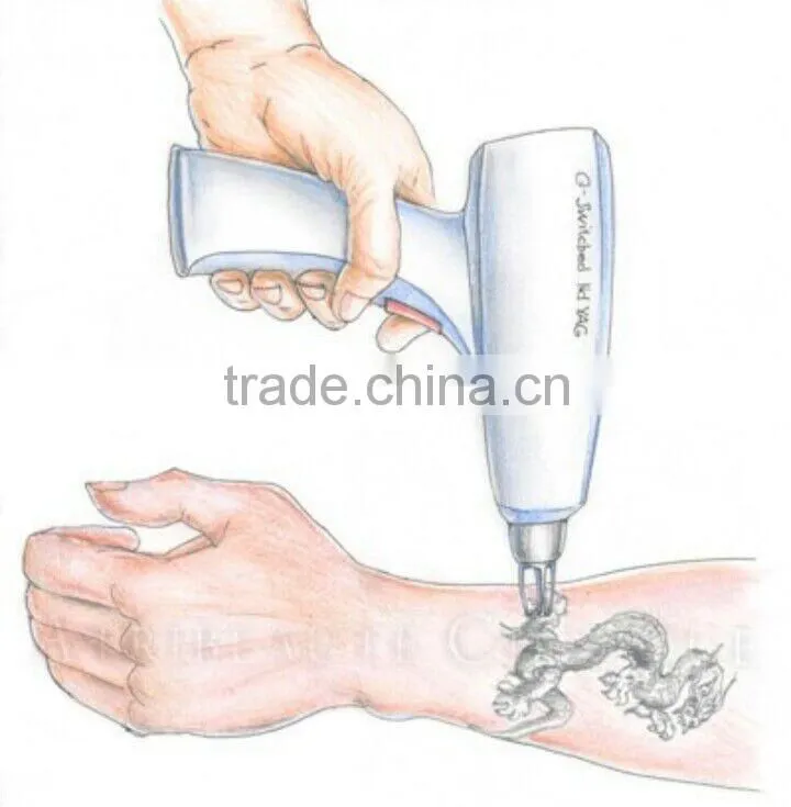Professional portable nd yag laser 1064nm korea for tattoo removal machine
