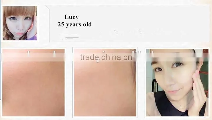The best Yingxue exfoliating scrub cream