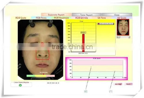 CE approved boxy skin & hair analyser