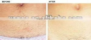 Newest IPL hair removal beauty salon beauty equipment