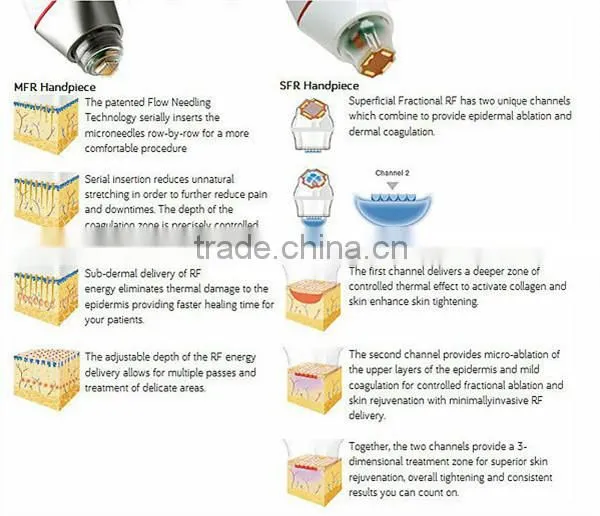 Factory price!!!rf fractional microneedle for Whiten Skin & Restore Skin Elasticity