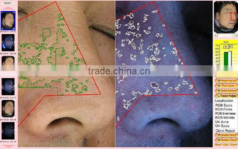 skin analyzer magnifier machine for sale