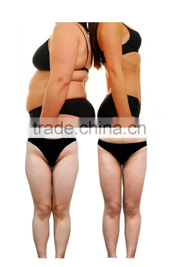 Micro machine quick-frezze 3 in 1 machine cryolipolysis slimming machine for home use