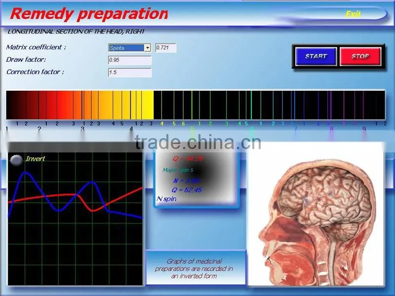 2016 hot 3d nls quantum health test machine with English and Spanish