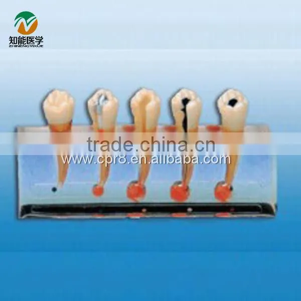BIX-L1011 Dental pulp disease model