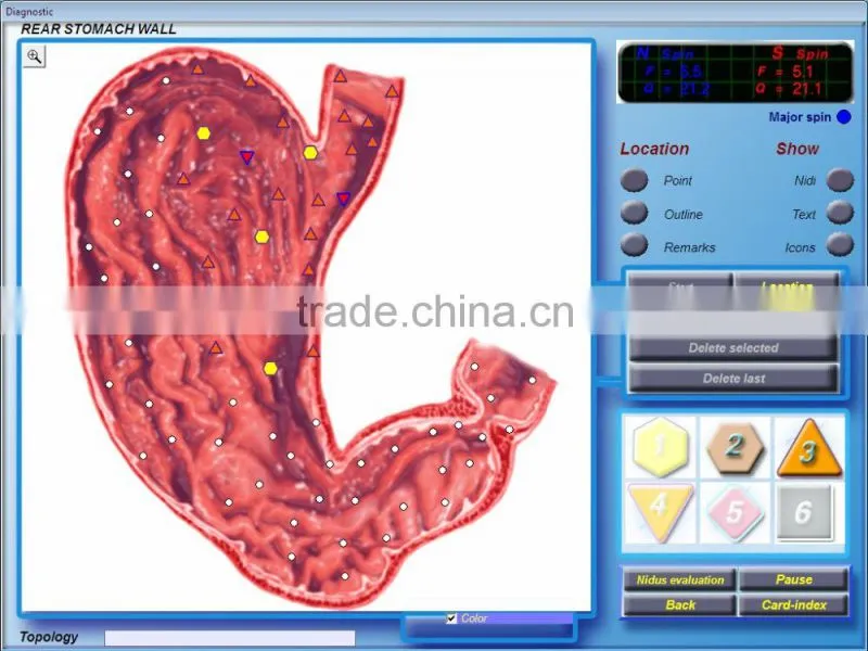 Quantum Analyzer 3D body health analyzer