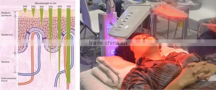LED Lights Home Pimple Removal Machine For Distributors Agents Required (BL-003) CE/ISO