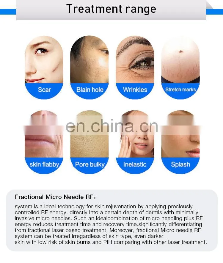 2019 New Fractional RF microneedle System Skin Tightening Machine Anti-wrinkle Stretch Mark Removal Facial Rejuvenation