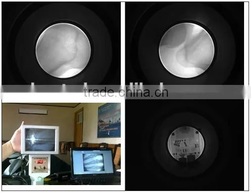 X Ray Machine