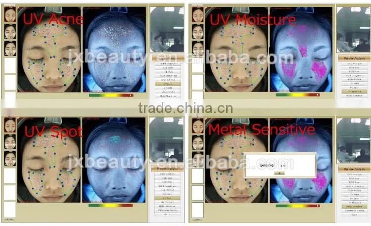 Portable skin analyzer skin scanner