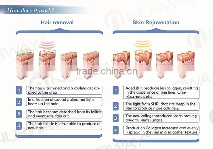 ipl skin rejuvenation shr ipl laser hair removal machine ipl shr e-light