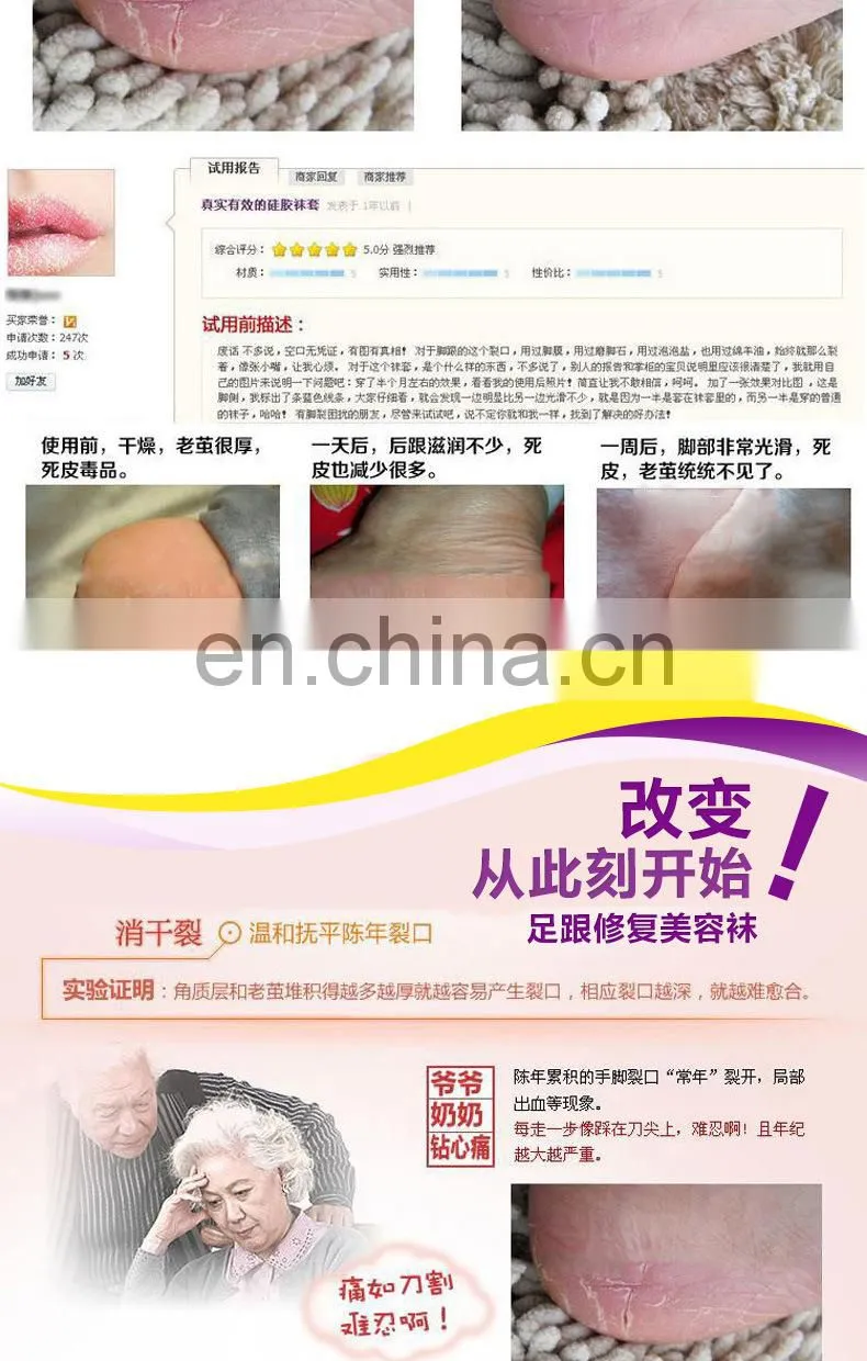 Moisturizing Cracked Heel Socks - Treat Dry Heels Fast Pain Relief from Cracking Feet with these Gel Heel Protector Pads