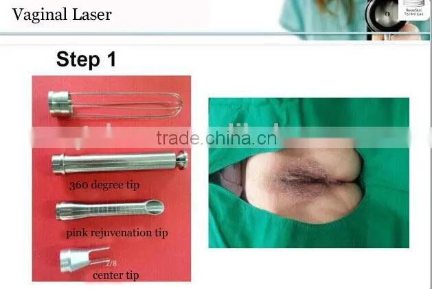 acne scar laser 60w RF tube CO2 fractional laser vaginal tightening/advanced laser