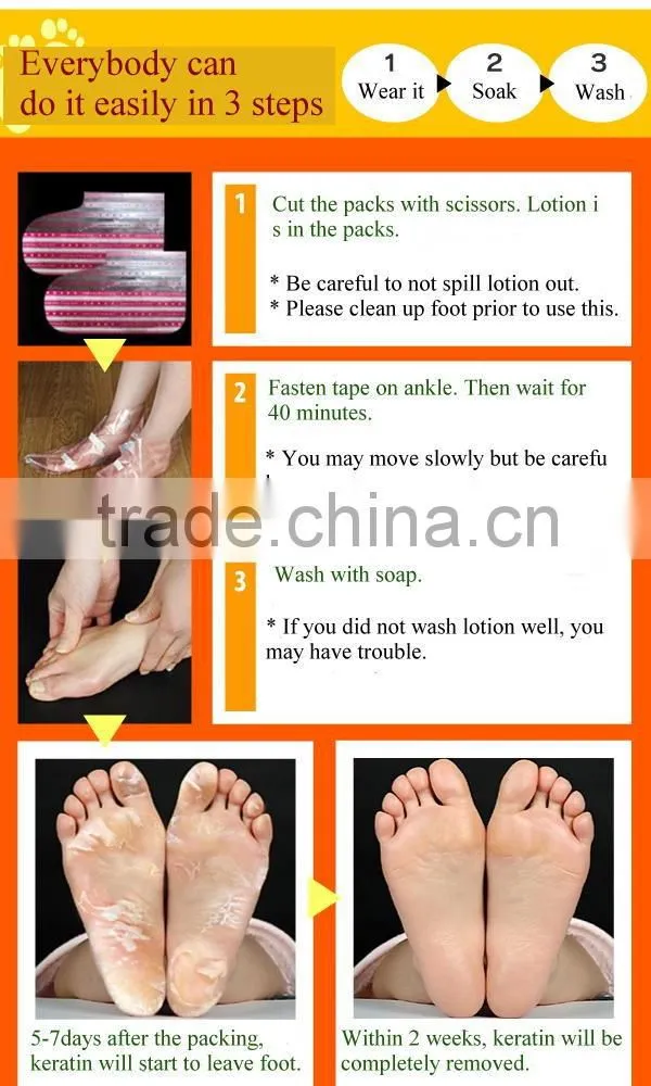 Safe foot keratin remover