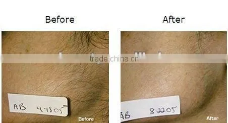 New IPL Professional Epilator--C003