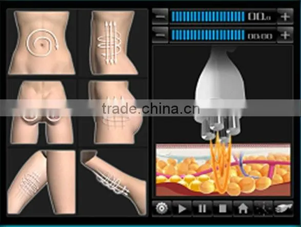 Skin Rejuvenation Device Coolipo V9
