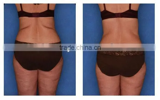 factory low price men body shaper weight loss equipment F019