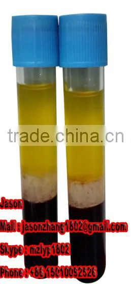 Non-pyrogen 10ml ACD anticoagulation prp kit