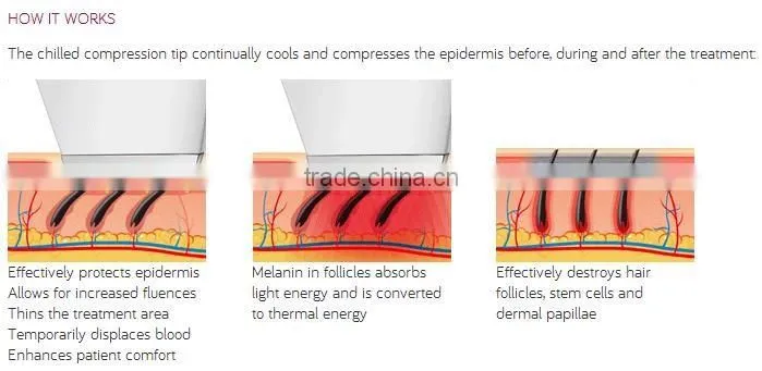 Nubway Most Attractive Design "Transformer" Soprano Diode Laser Skin Hair Removal IPL Machine