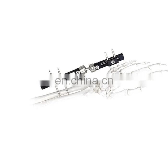 High Quality Wrist Joint External Fixator Orthopedic Surgical Instrument
