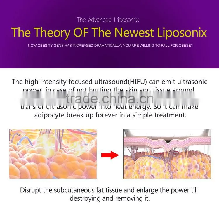 The Hot Selling Hifu Ultrasound Body Shaping Machine With Lowest Price