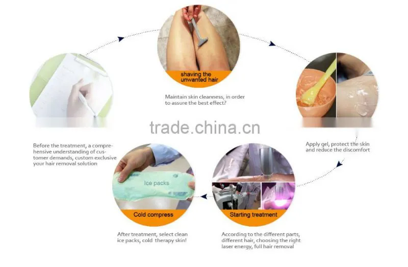 New products bikini line hair removal machine 808nm diode laser hair removal